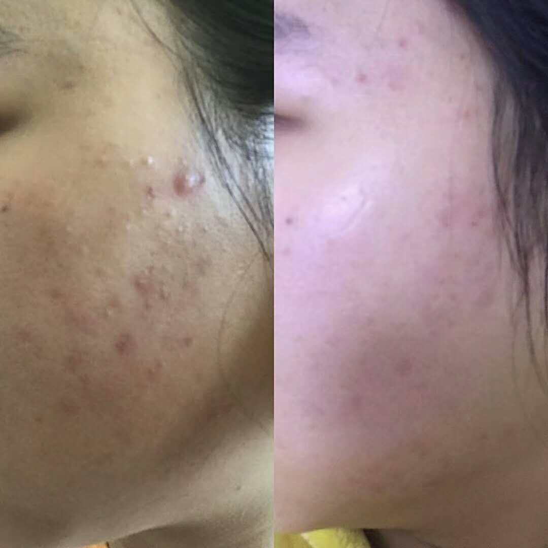 蔓之研怎么代理？代理蔓之研需要多少钱?