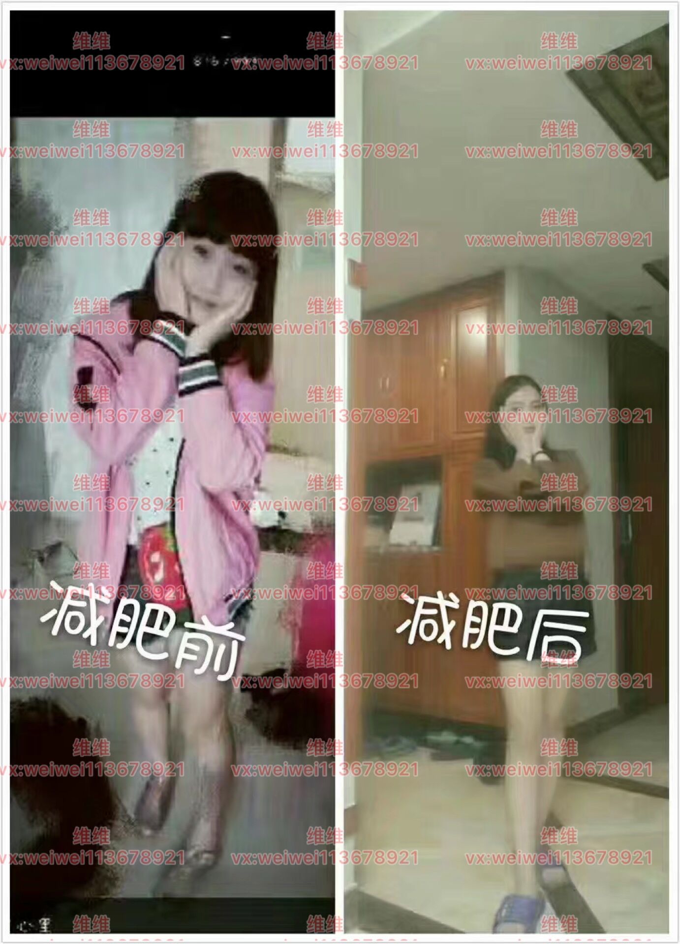 瘦身一件代发。保证效果可售后