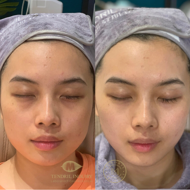 蔓之研骨针霜是什么，效果怎么样