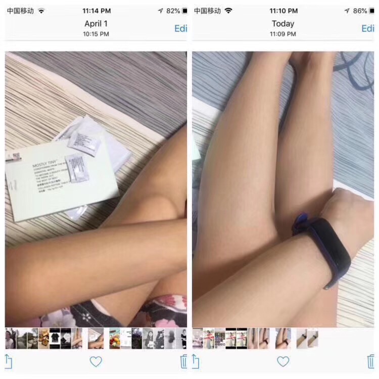 mos美白片真的能美白吗 多久美白?