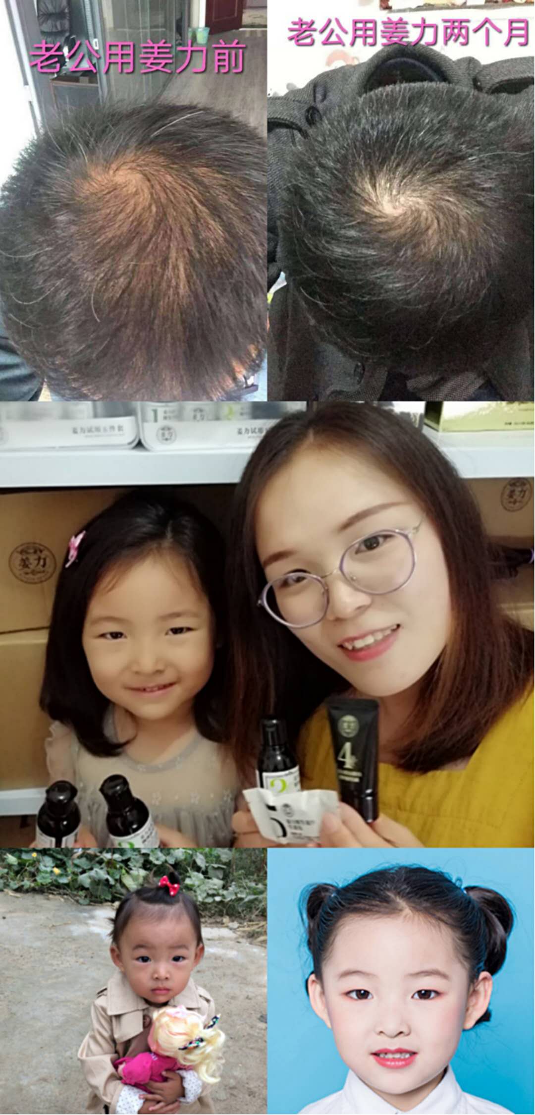 姜力洗发水怎么代理?