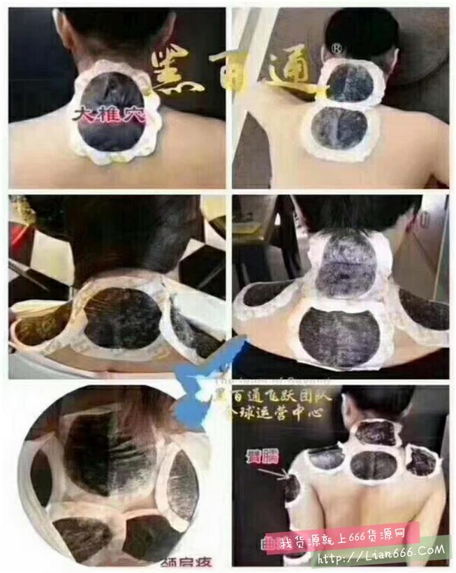 黑百通价格多少钱,代理拿货价格又是多少? 黑百通微商代理