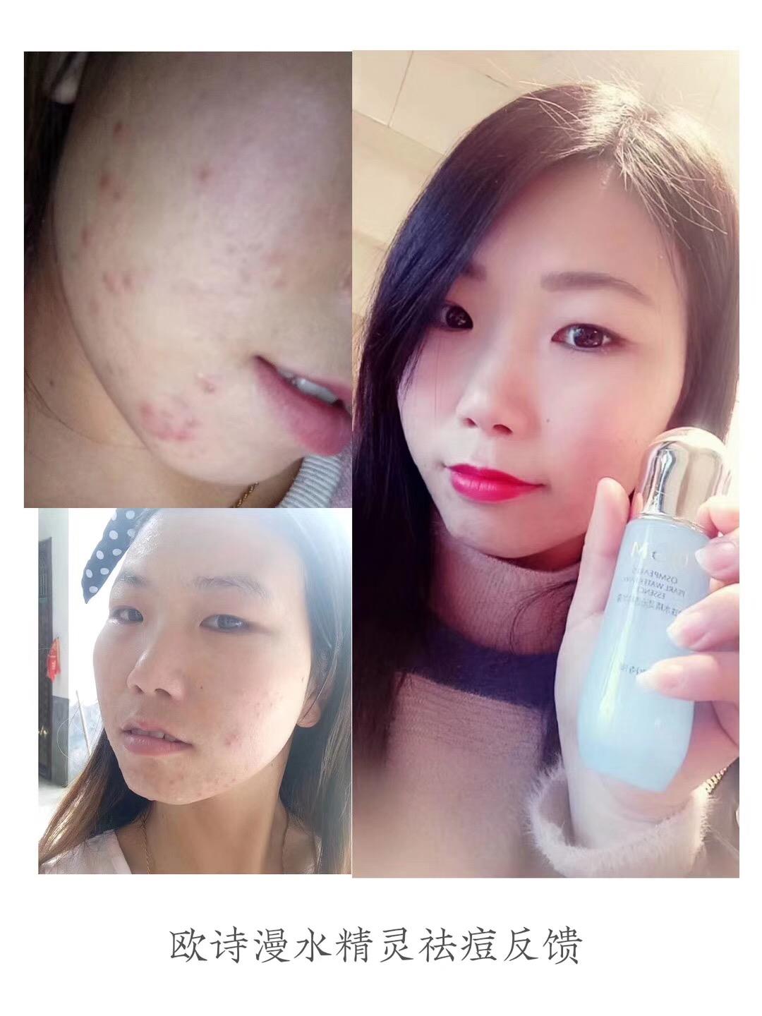 欧诗漫珍珠白 OSM欧诗漫珍珠白系列产品零费用零微商代理