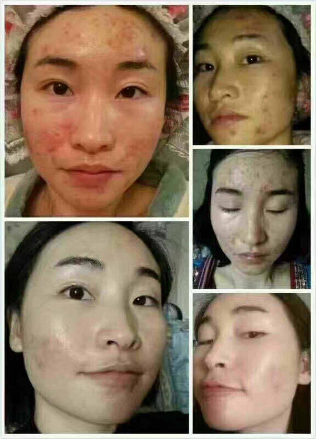 微商免费加盟 免费加盟，不囤货