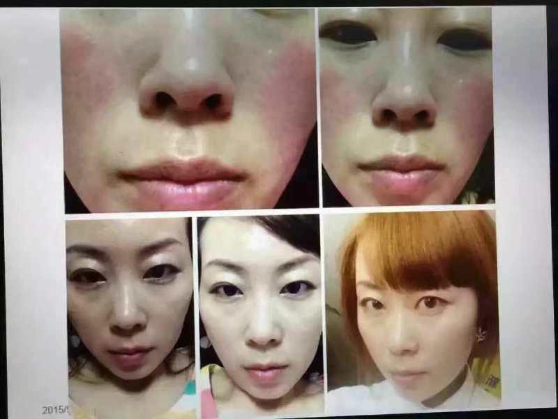 微商免费加盟 免费加盟，不囤货