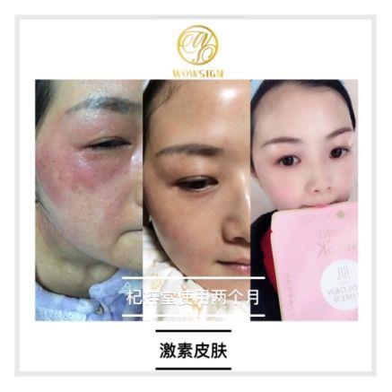 杞梓堂黑白鹿角林芝面膜好不好?杞梓堂黑白鹿角林芝面膜怎么样？