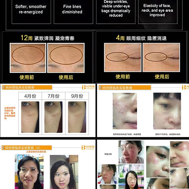 珂纳偲纳米黄金面膜，肌透修复液，修复天生脆弱敏感，铅汞激素脸。