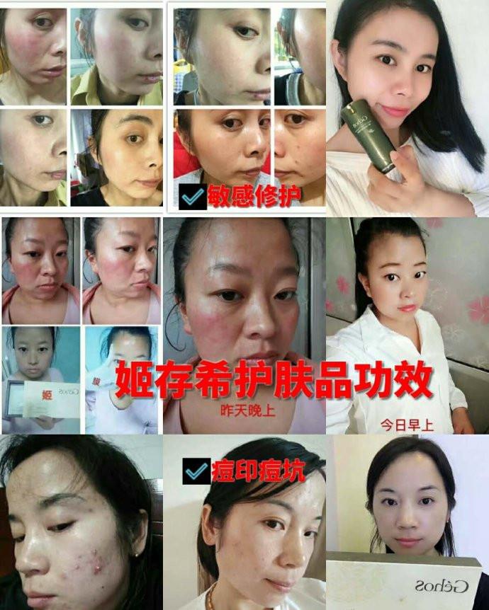 姬存希护肤品好用吗?姬存希护肤品代理怎么代理
