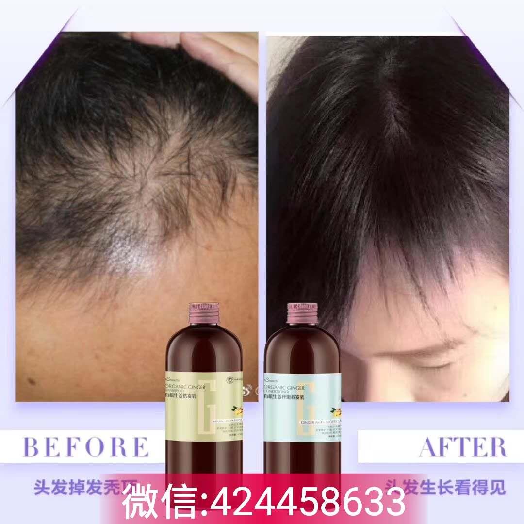 田七生姜洗发乳真的好用吗？真的能长头发吗？