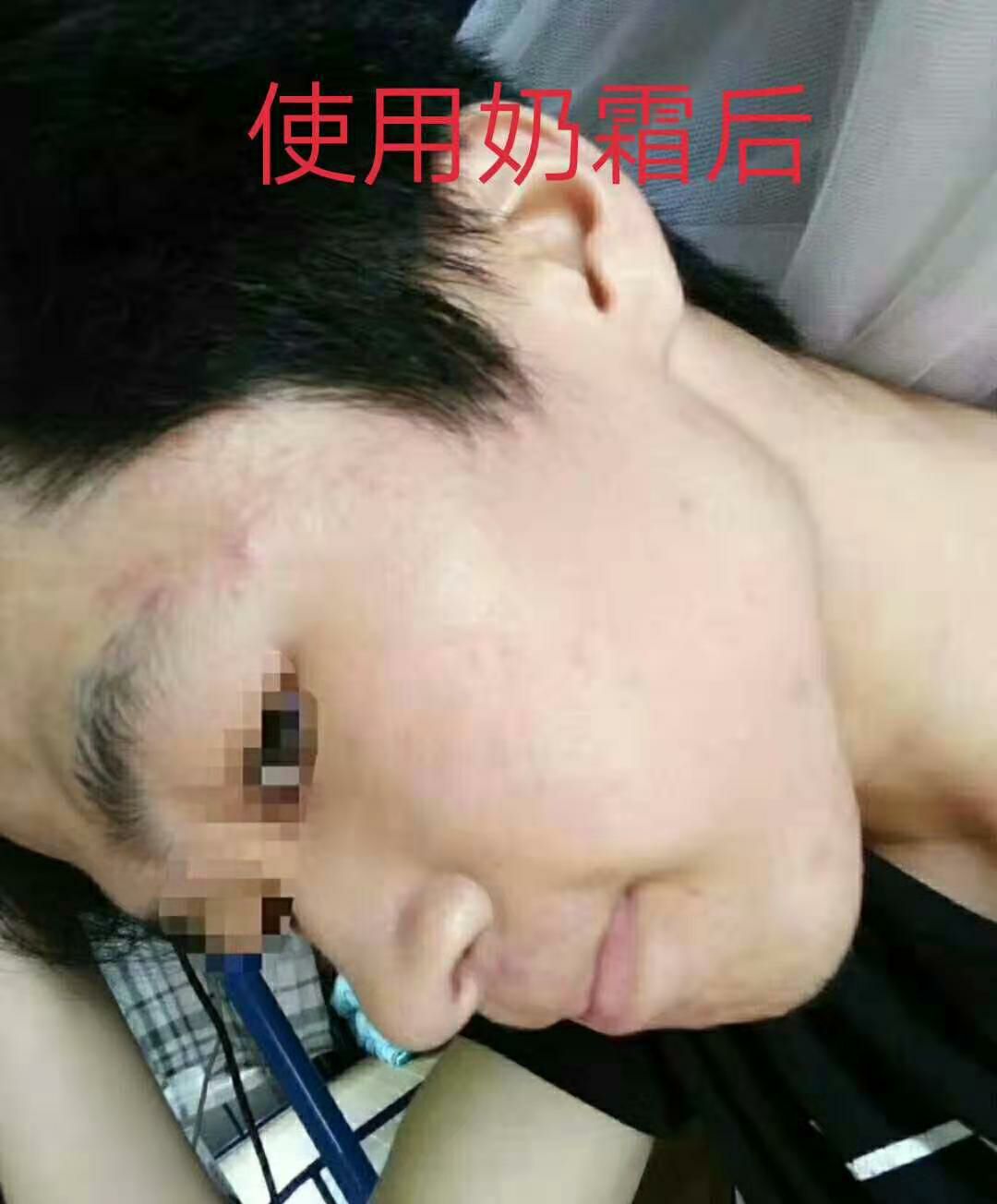♡牛奶布丁霜♡安全到可以吃❗排毒美白❗提亮肤色❗淡化黑头素❗