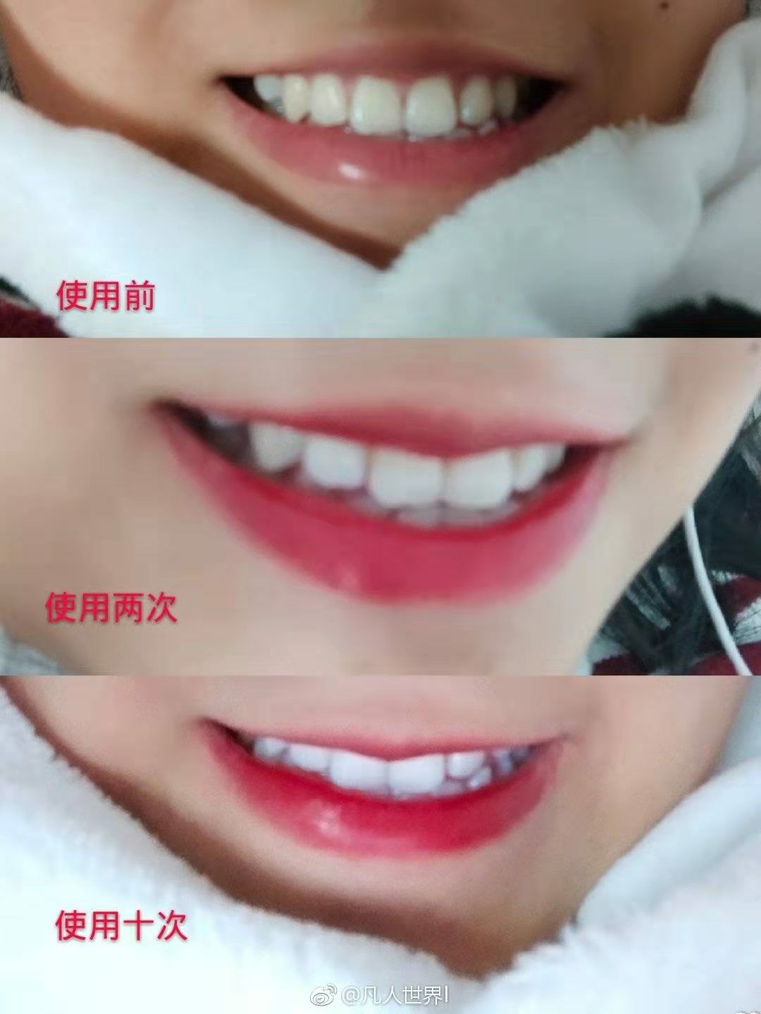 碧缇福美牙仪 护颈仪 招代理 暴富呀~