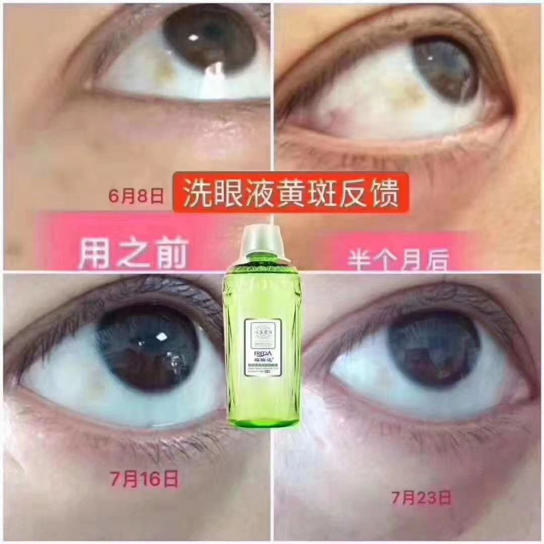 福瑞达心生爱目洗眼液，解决你一切的眼部问题！