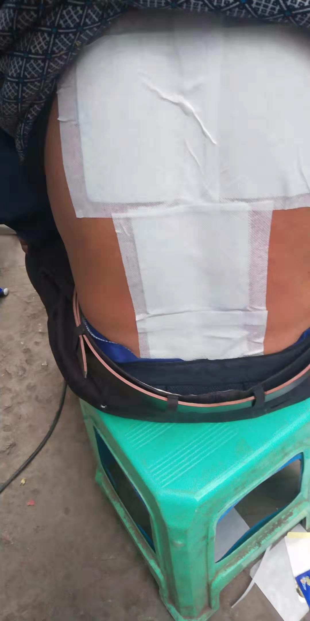 九溪堂苗帮正极冷敷贴 专治颈椎病，肩周炎