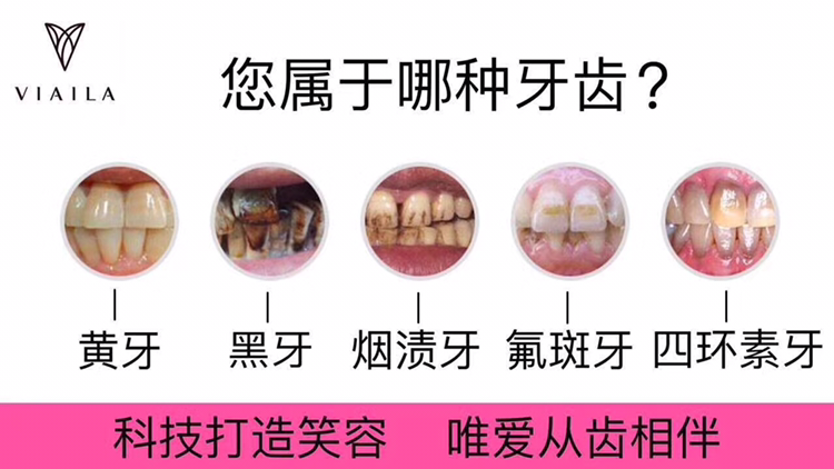 唯爱冷光牙齿美白仪  7-15天见效 无效退款 招代理 手把手教学