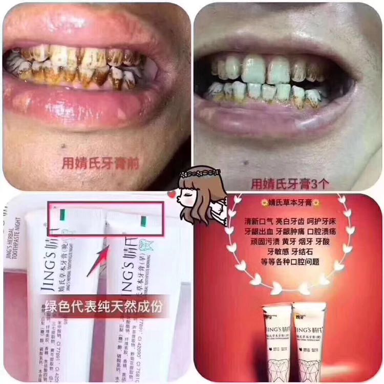 婧氏草本牙膏，关注你的口腔健康