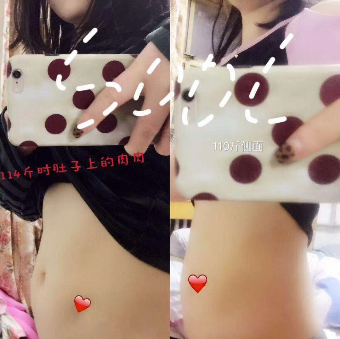 纯中药减肥！不节食。不运动。不反弹，无副作用！无效退款！