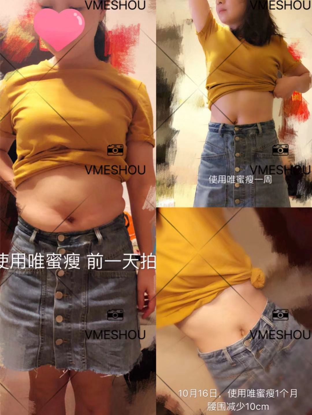 唯蜜瘦减肥瘦身，一款哺乳期妈妈都可以用的瘦身产品