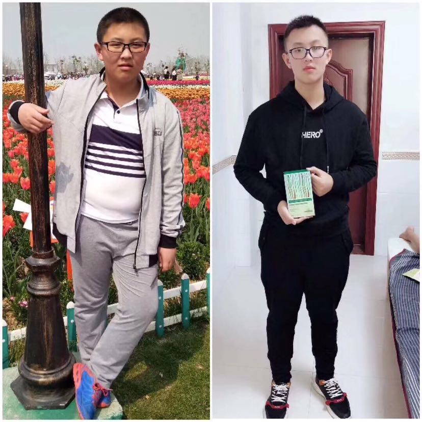 中科特殊膳食减肥