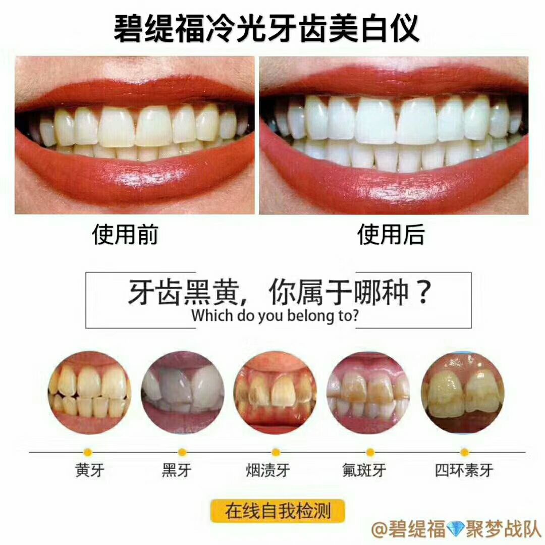 碧缇福美牙仪