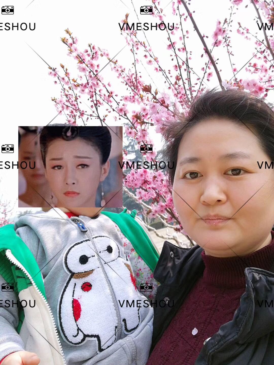 唯蜜瘦减肥瘦身，一款哺乳期妈妈都可以用的瘦身产品