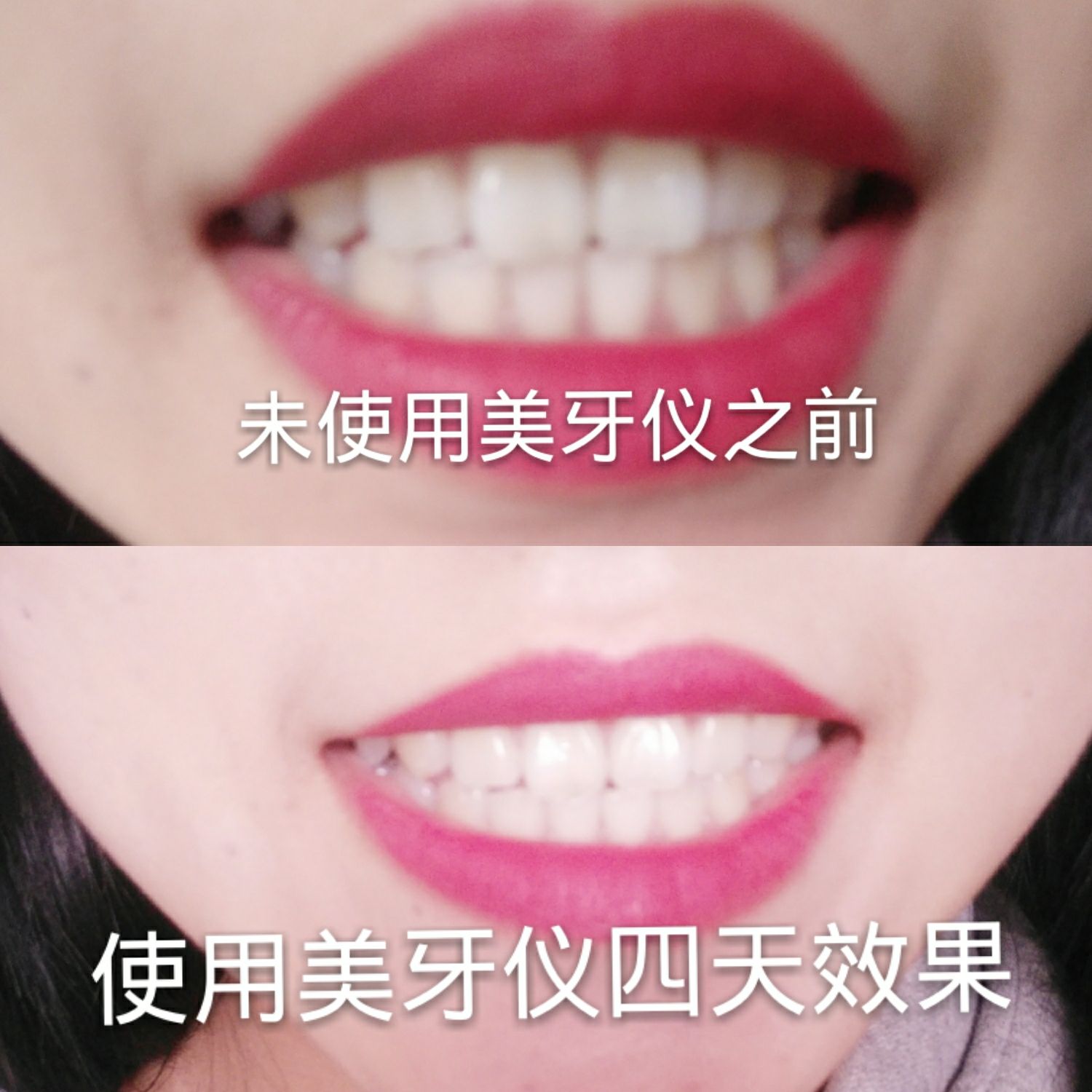 碧福缇美牙仪 让你四到七天有效果 无效退款