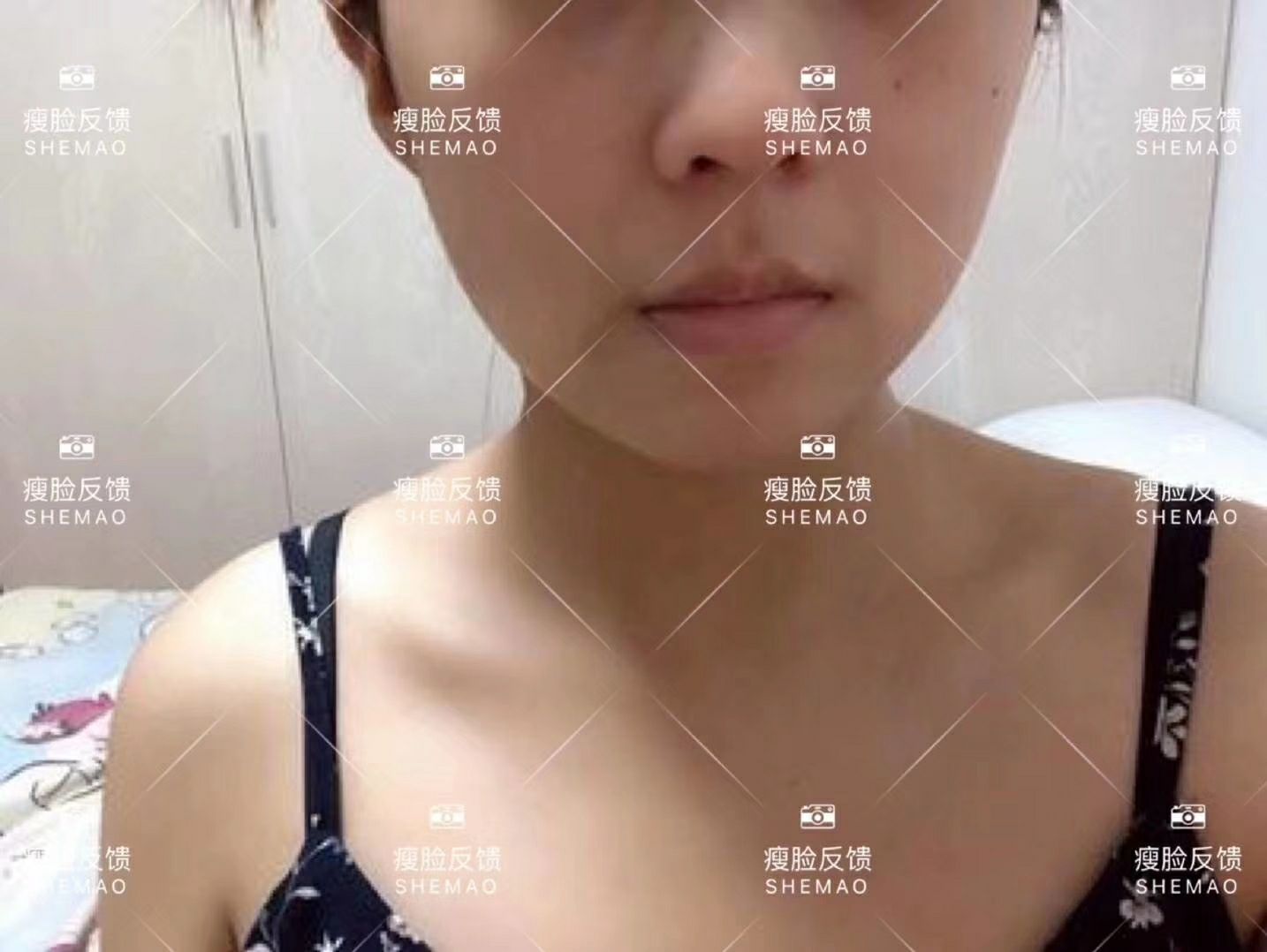 奢貌瘦脸面膜