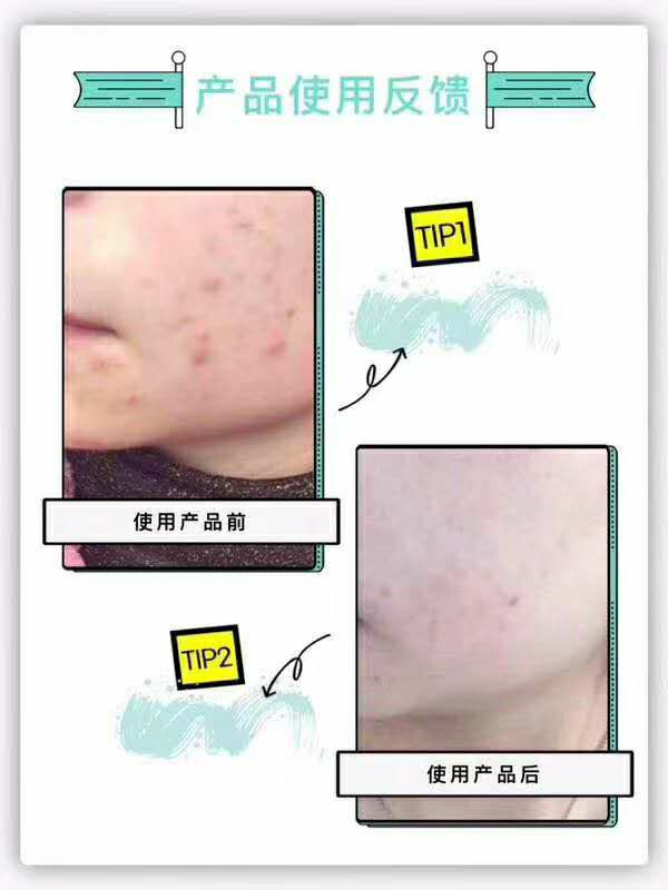 网红小蓝瓶 代替水乳霜三合一