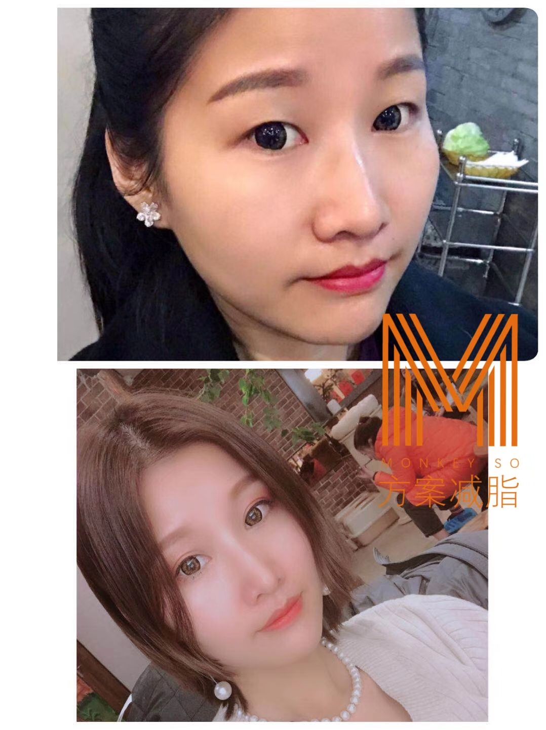 MONKEYSO减肥食品 一对一跟踪服务指导改善饮食结构