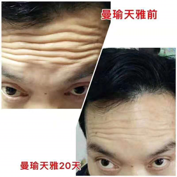 曼瑜天雅 排毒抗衰老 从此告别粗糙无光泽