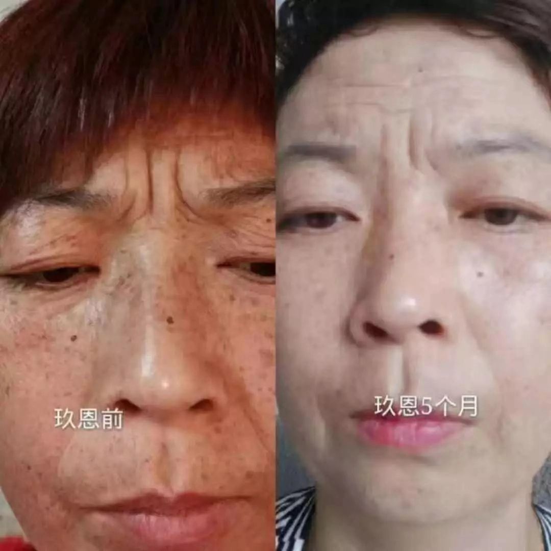 玖恩青春定格液，修复面部所有肌肤问题