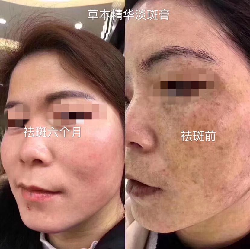 中药珍珠护肤品 全国直招代理 批发 厂家直销