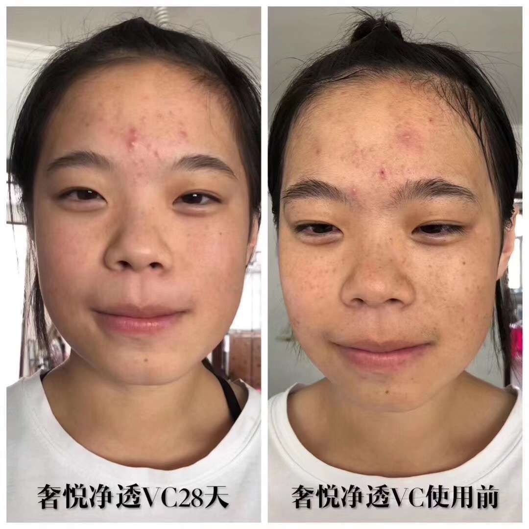 奢悦vc精华，净透vc精华，大大效果提亮肤色