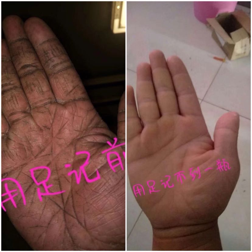专业治脚气，一瓶只需35