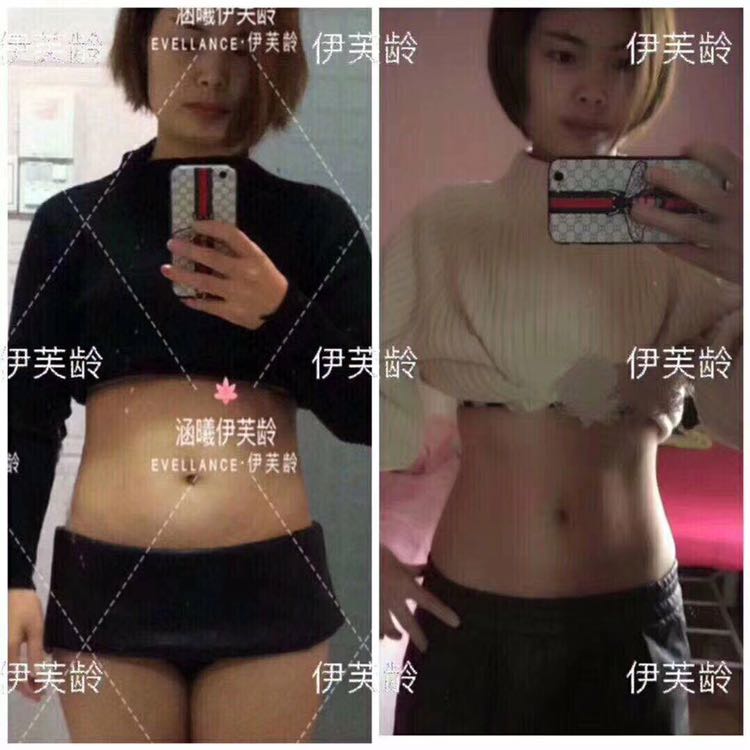 涵曦LATOJA紧致换肤减肥膏 全国招代理