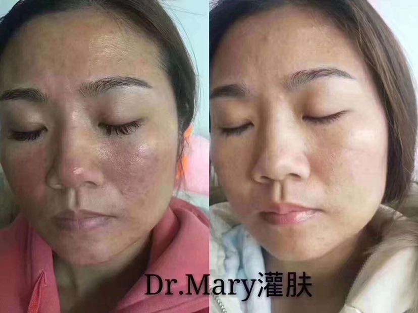 玛丽博士免费体验罐肤