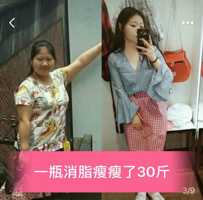 ZS消脂瘦带你月瘦10到20斤