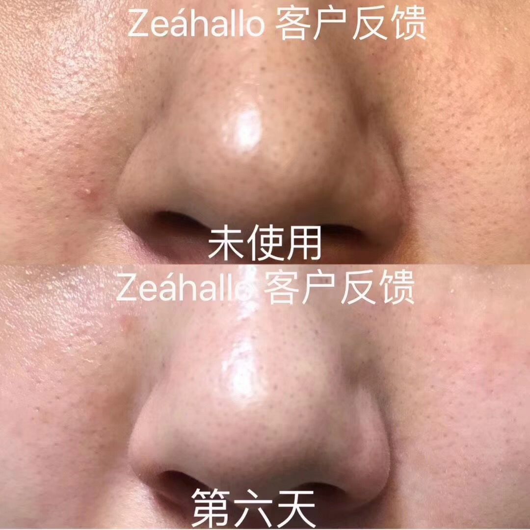 滋活焕颜排毒素 全面滋养调理皮肤的美肤产品