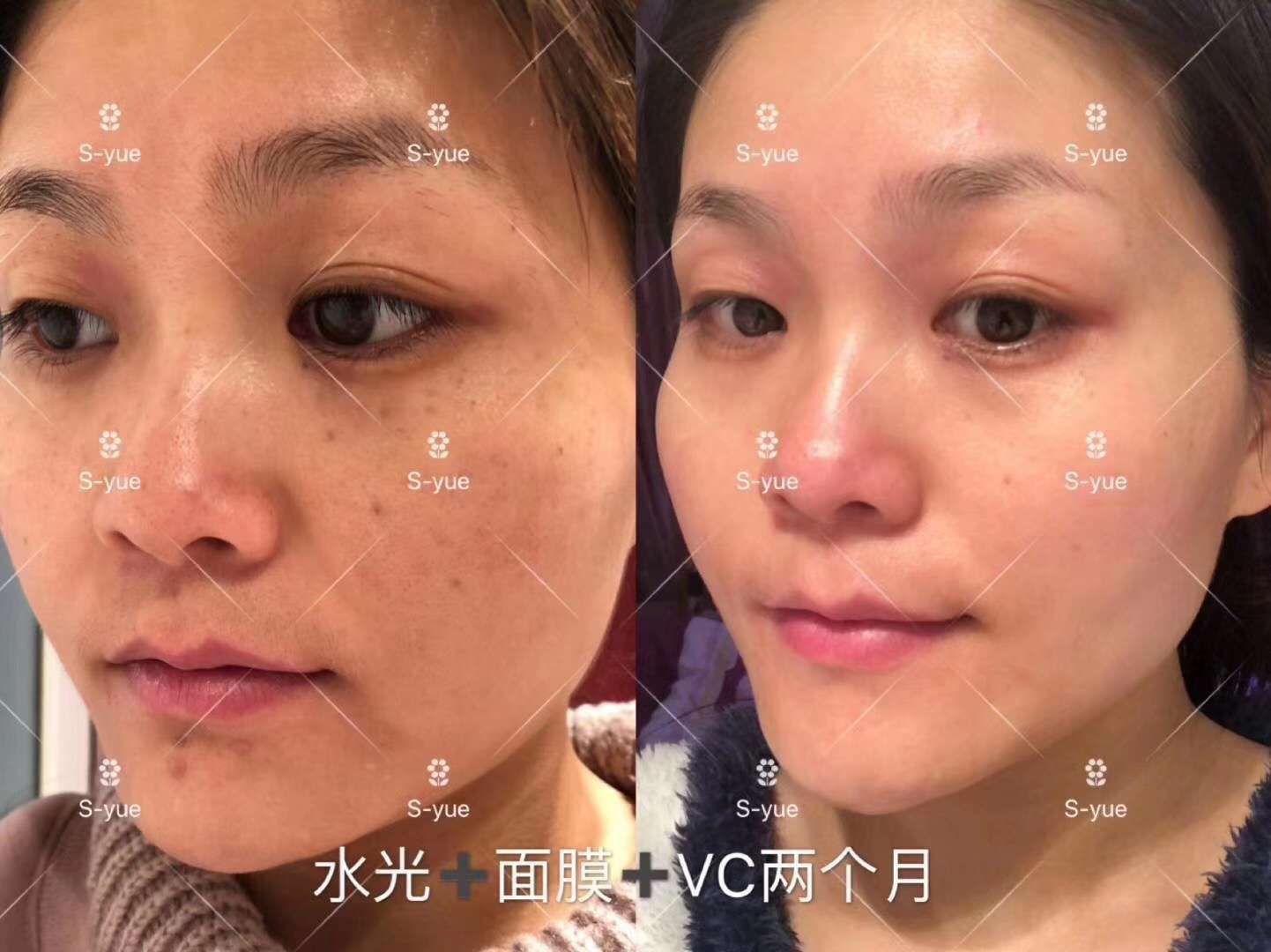 奢悦vc精华，净透vc精华，大大效果提亮肤色