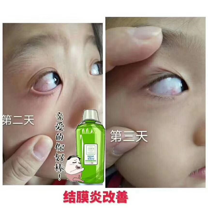 国企微商，福瑞达心生爱目洗眼液