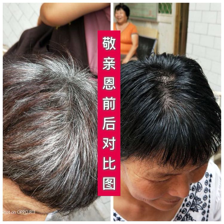 双迪敬亲恩白转黑洗发水 昊尊洗出彩