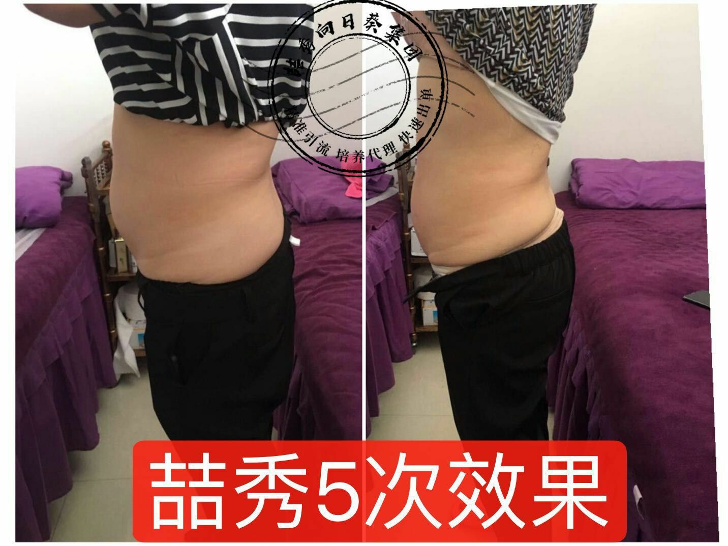 喆秀健康减肥，✅每天通经络15分钟提高代谢包保鲜膜每天瘦