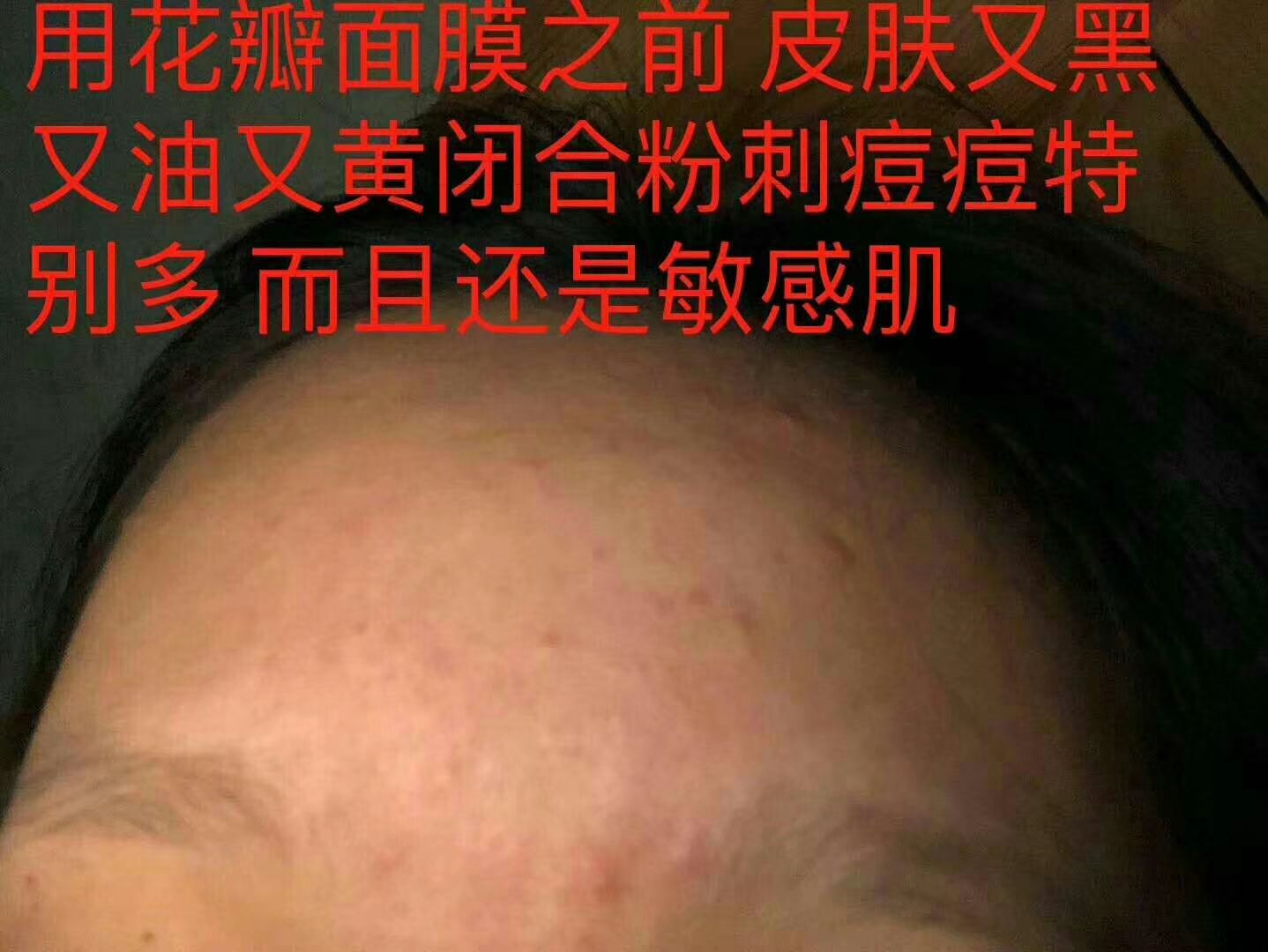 冰亦花瓣冰膜 。美白补水祛痘淡斑，促进皮肤的新陈代谢  …