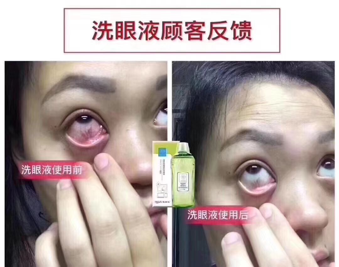 国企微商，福瑞达心生爱目洗眼液