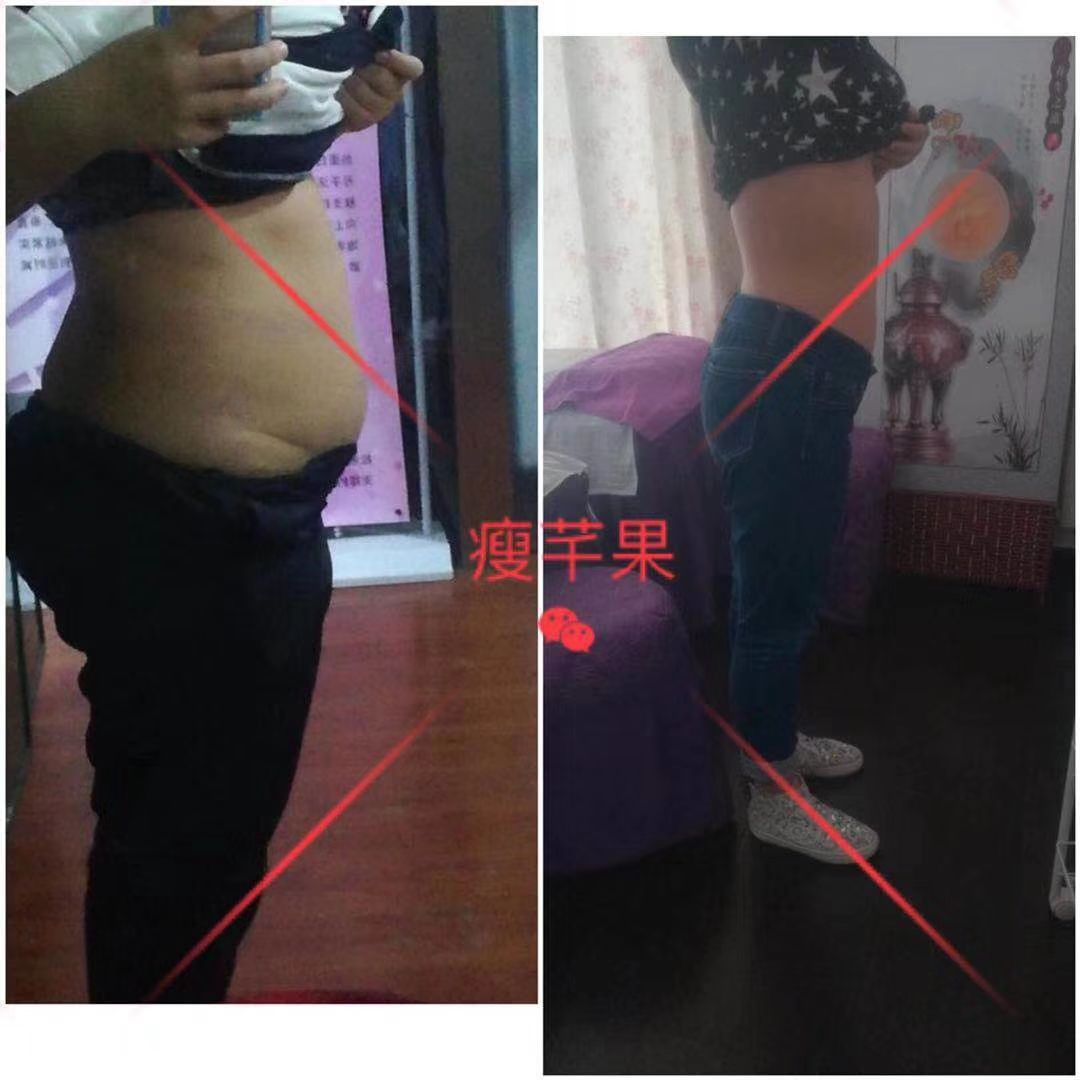瘦芊果减肥果片