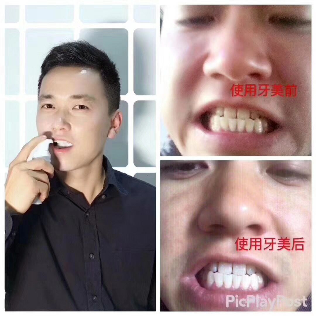 南京同仁堂洁白慕斯牙美 代替牙膏漱口水