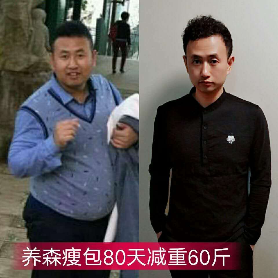 养森瘦包纯中药外敷减肥 月瘦10-30斤