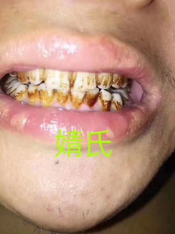 婧氏草本牙膏