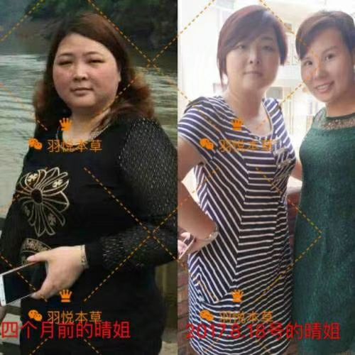 瘦瘦包还你美丽健康 无任何副作用