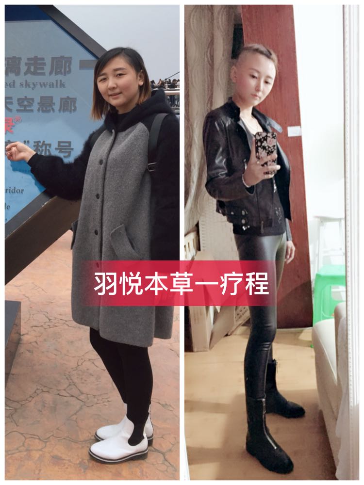 羽悦本草瘦瘦包 招代理