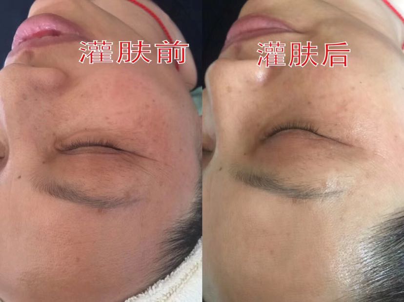 玛丽博士免费体验罐肤